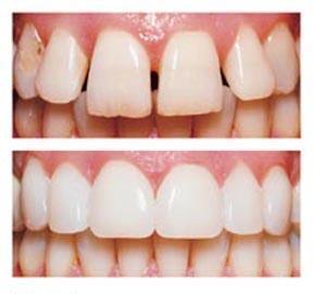 Cosmetic Dentistry in Brampton